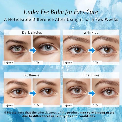Dewyhour Under Eye Balm Stick - Cooling Moisturizing Treatment for Dark Circles & Puffiness | Korean Skin Care