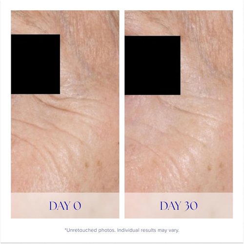 iS CLINICAL Youth Eye Complex - Anti-Aging Brightening Under Eye Cream for Puffiness & Hydration