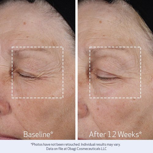Obagi ELASTIderm Lift Up & Sculpt Facial Moisturizer - Clinically Proven Anti-Aging Cream for Firming & Smoothing - 1.7 oz