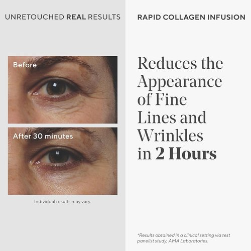 Murad Rapid Collagen Infusion - Anti-Aging Serum with Collagen Amino Acids & Winged Kelp Extract | 1.0 Fl Oz for Visible Wrinkle Reduction & Enhanced Skin Firmness