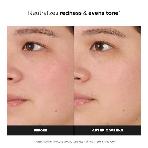Paula's Choice SKIN BALANCING Face Toner - Pore-Reducing Niacinamide Formula for Oily & Combination Skin, Fragrance-Free