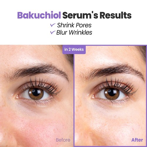 Glam Up Bakuchiol Serum - Anti-Aging Retinol Alternative with Hyaluronic Acid | Hydrates & Soothes Skin (1.01 Fl Oz)