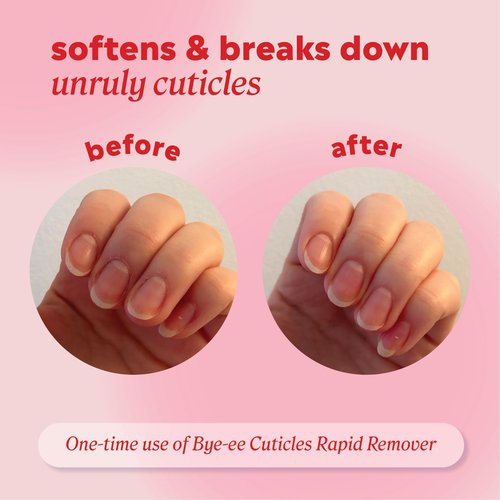 ONYX Professional Bye-ee Cuticles Rapid Remover, Vanilla Coconut Scent - Cuticle Remover Gel with Built-In Cuticle Pusher, Cuticle Pusher Tool for Cuticle Softening and Nail Prep, 0.43 fl. oz