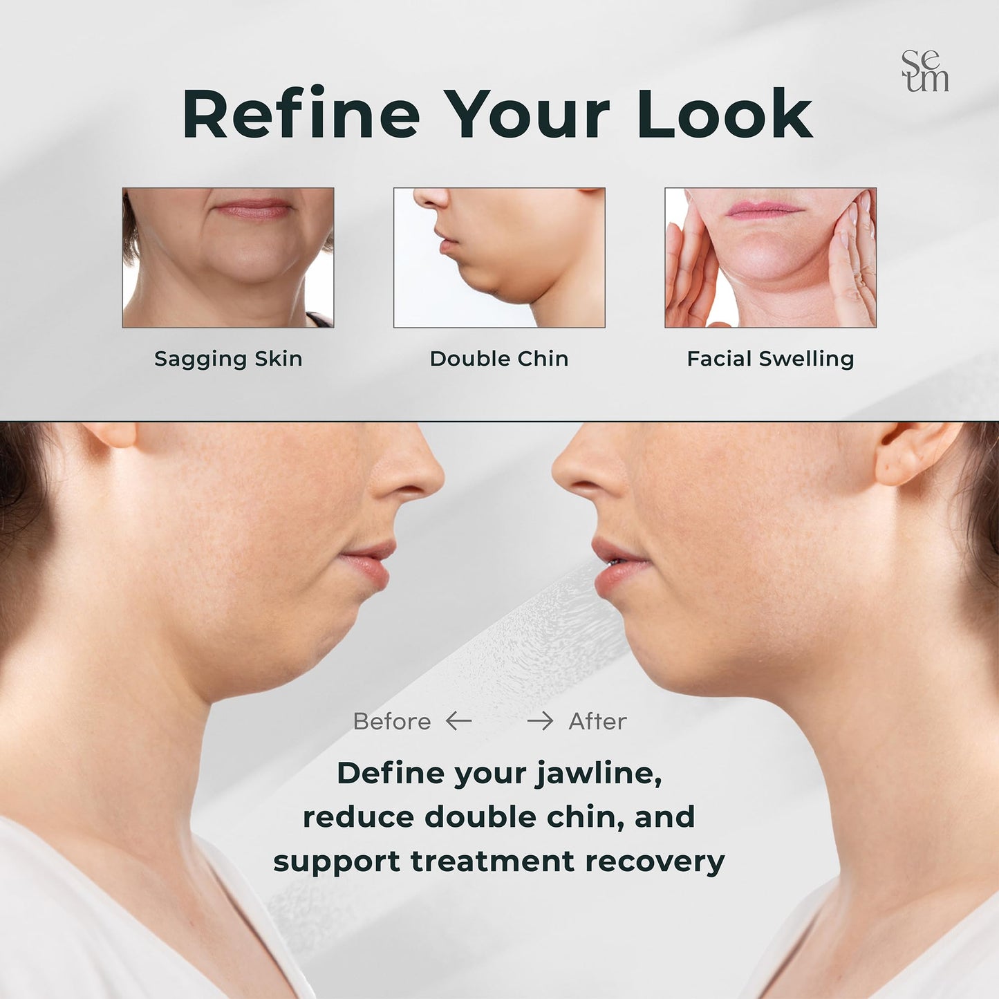 SEUM K-Beauty Korean V Line Lifting Band – Double Chin Strap,Face Lift Device,Jawline Shaper, V Line Lifting Mask,Jaw strap,Chin strap for sleeping,Best Face lifting device,Facelift device