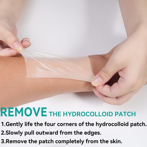 New Hydrocolloid Roll,2in*5ft Hydrocolloid Bandages for Wound Care,Medical-Grade Hydrocolloid Patch Bandages with Self-Adhesive, Flexible & Waterproof DIY Size & Shape (5FT)