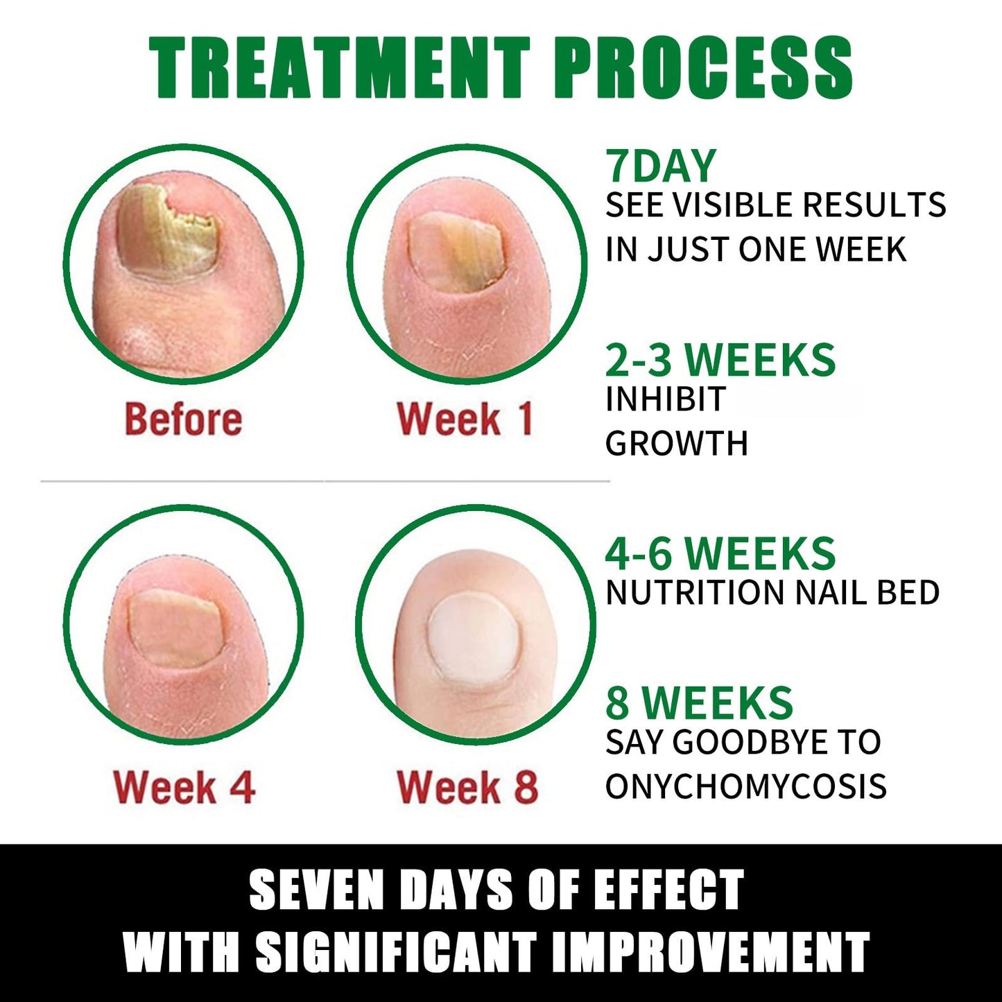 7 Days Ginger Foot Spray, 7 Days Nail Repair, 7 Days Ginger Nail Treatment, Ginger Nail Treatment (1pcs)
