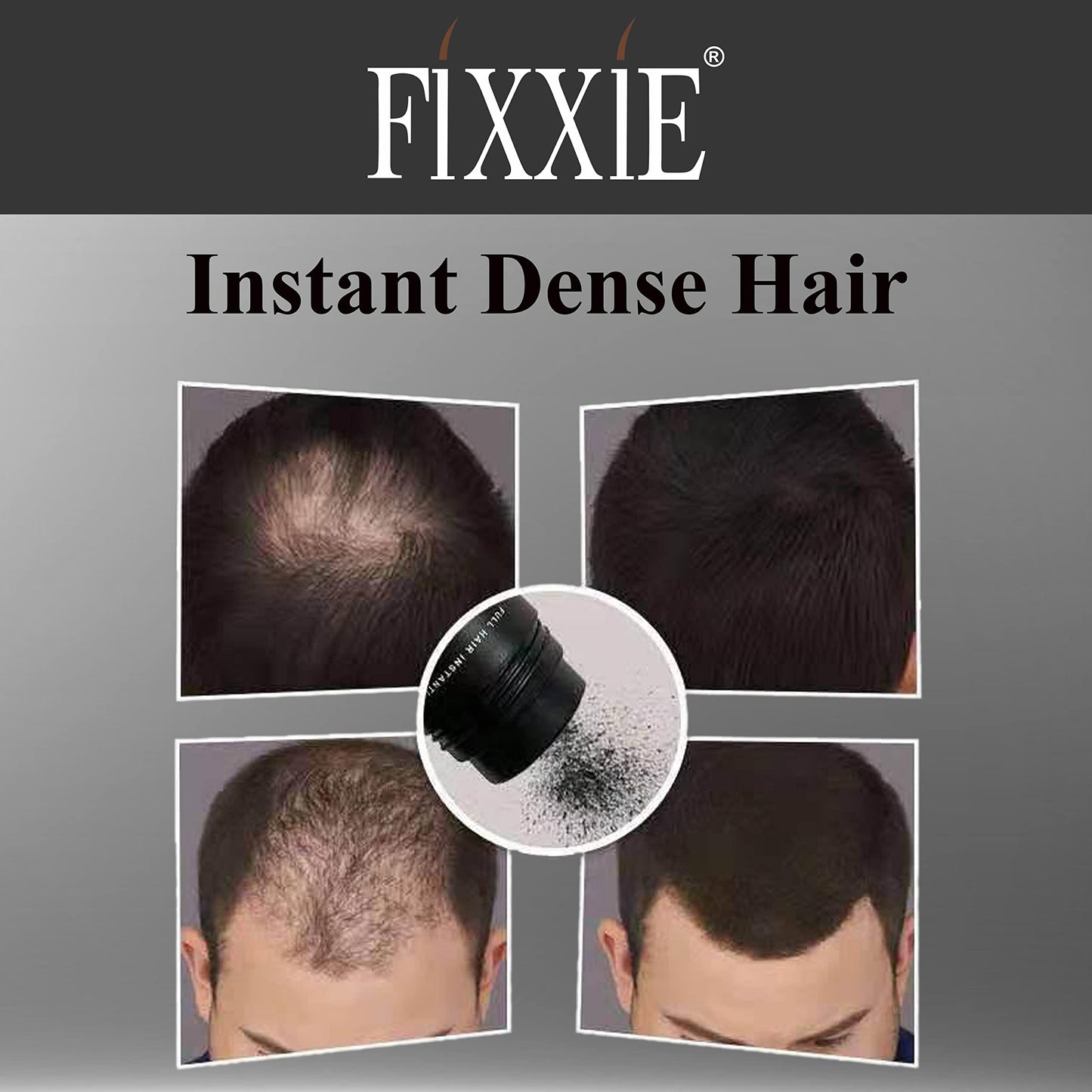 FIXXIE Hair Fibers DARK BLONDE for Thinning Hair 27.5g Bottle, Hair Fibre Concealer for Hair Loss for Men and Women, Naturally Thicker Looking Hair with Keratin Hair Fibres