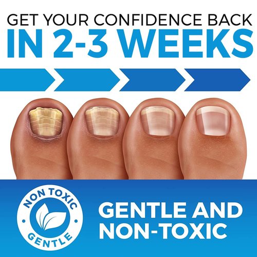 Toenail Fungus Treatment Extra Strength (FDA REGISTERED) - Fungi Nail Fungus Cream - XL - Nail Strengthener and Growth Improved Formula (Made in USA)