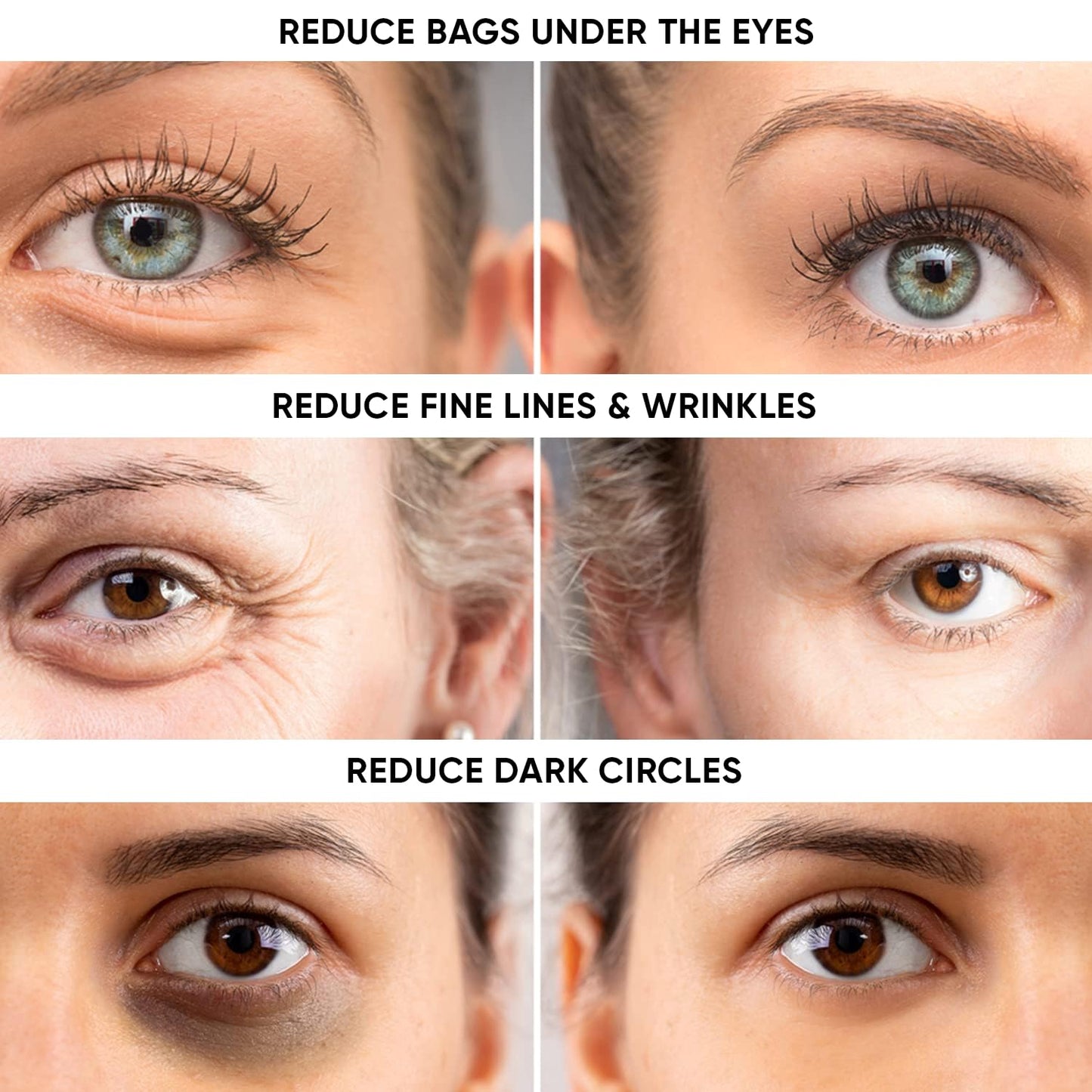 Skiennix Instant Eye Tightener Cream - Reduces Puffiness & Dark Circles | Firm & Lift Sagging Skin