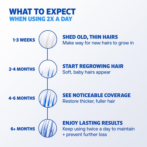 Men’s Rogaine 5% Minoxidil for Men Foam, Clinically Proven Regrowth for Thinning Hair, Topical Hair Loss Treatment, Unscented Topical Aerosol, Results in 8–16 Weeks, 3-Month Supply, 3 x 2.11 oz