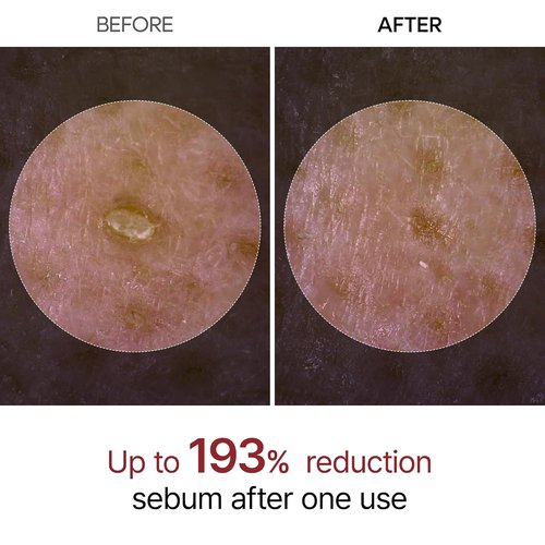 Dr.Melaxin Glow White Rice Peeling Ampoule - Brightening Exfoliating Serum with AHA/BHA & Niacinamide, 2.71 fl. oz.