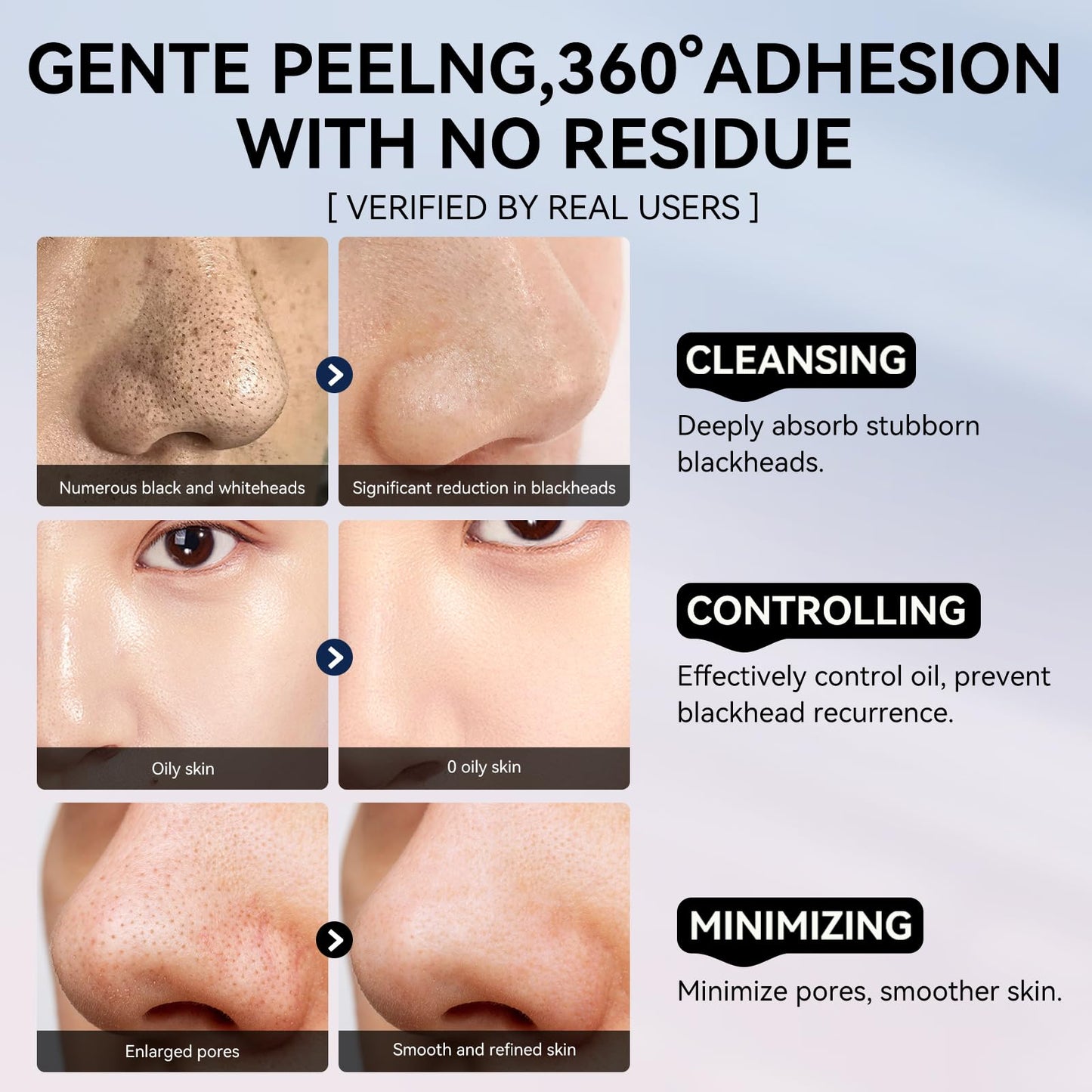 LANBENA 3-in-1 Blackhead Removal Set - Pore Strips (30g), Pore Minimizing Serum (30ml) & Removal Paper - Mask for Face, Minimizes Pores & Leaves Skin Fresh & Clean, Blackhead Remover