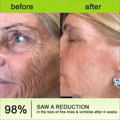 Botoxmix & Vita-A Retinol Shot Wrinkle-Lift Tightening Cream, Wrinkle-Lift Tightening Cream, effectively lifts and firms the skin, and reduces wrinkles and fine lines. (1PC)
