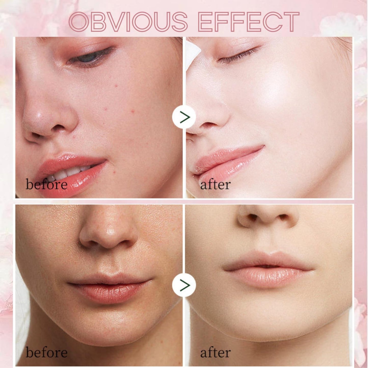 Japan Sakura Skincare Set - 8 Pcs Teenage Skin Care Set - Skin Care for Teens 10-12 - Skincare for Girls 10-12 - Teen Skin Care Kit with Sleeping Face Mask,Cleanser,Face Cream,Headband