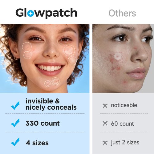 Glowpatch Pimple Patches for Face, Invisible Acne Patches 330 Count, Daytime Ultra Thin Spot Stickers for Covering Blemishes, Original Hydrocolloid Zit Patch 4 Sizes for Overnight Care (Day + Night)