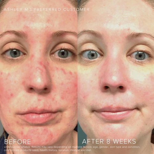 Rodan + Fields Soothe Daily Mineral Sunscreen SPF 30 - Zinc Oxide Face Moisturizer | 1 Fl Oz Travel Size