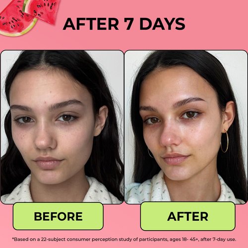 Avatara The Water Drop Milky Hydration Serum – Lightweight Water-Based Daily Face Moisturizer for Teens – With Kombucha, Watermelon & Hyaluronic Acid – Soothes, Hydrates & Balances, All Skin Types