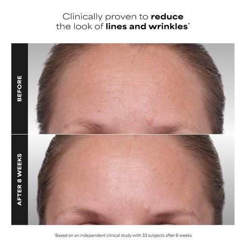 Paula's Choice Clinical 1% Retinol Face Treatment - Anti-Aging Serum with Peptides & Vitamin C | Fragrance-Free