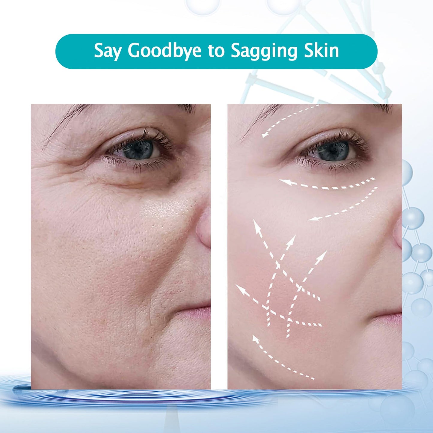 ESTEVO PDO Screw Thread, Improves Skin, Lift and Restore Skin Elasticity and Radiance, Pdo Thread Increase Firmness (20PCS-27G*60mm)