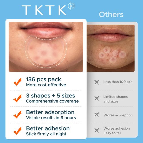 TKTK Pimple Patches Pimple Patches for Face Hydrocolloid Acne Patches Zit Patches for Chin and Nose Skin Care 5 Sizes 136 Count