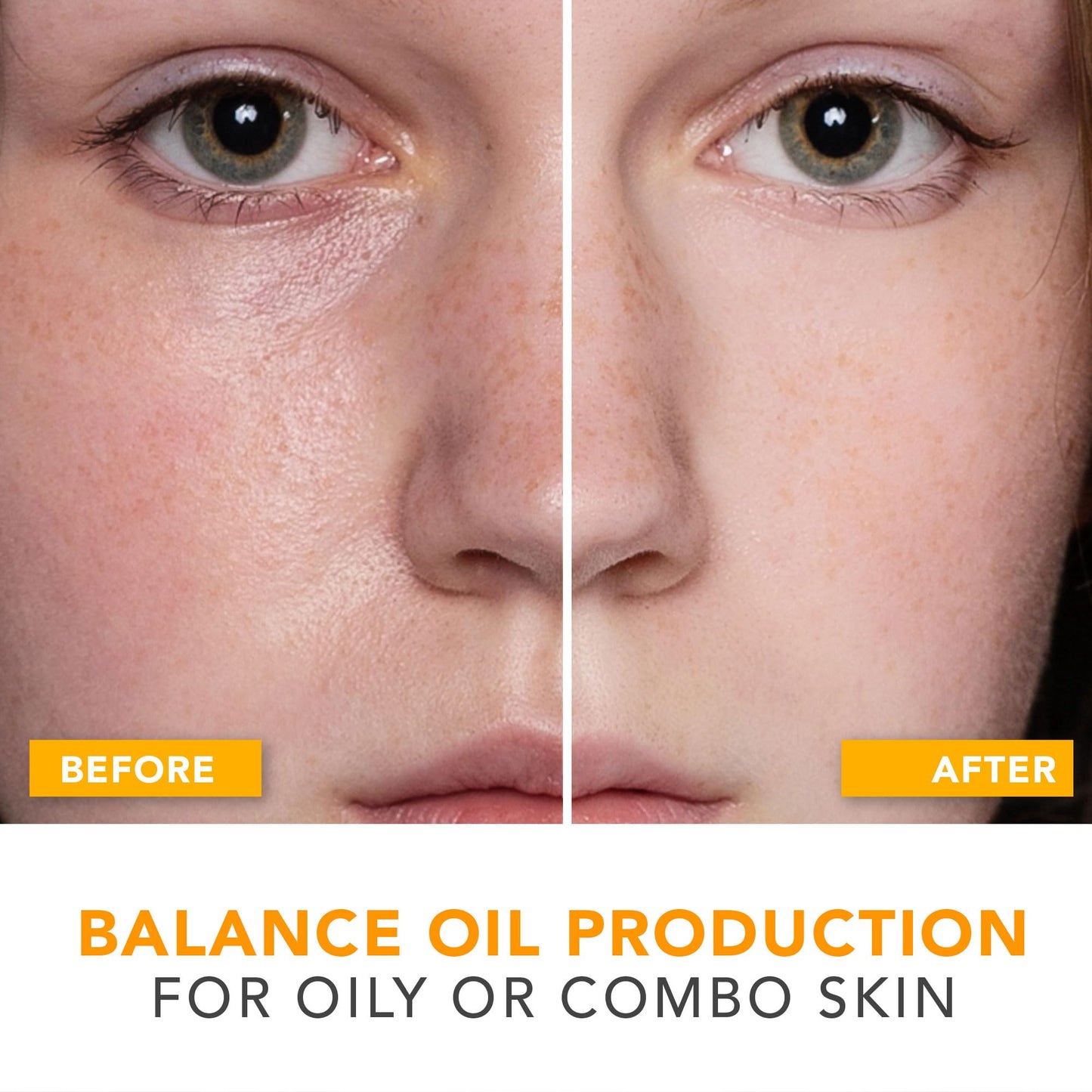 Oil Control Face Moisturizer - USA Made with Natural & Organic Ingredients, Lightweight and Mattifying Moisturizer for Oily & Acne Prone Skin, Face Cream with Niacinamide and Hyaluronic Acid