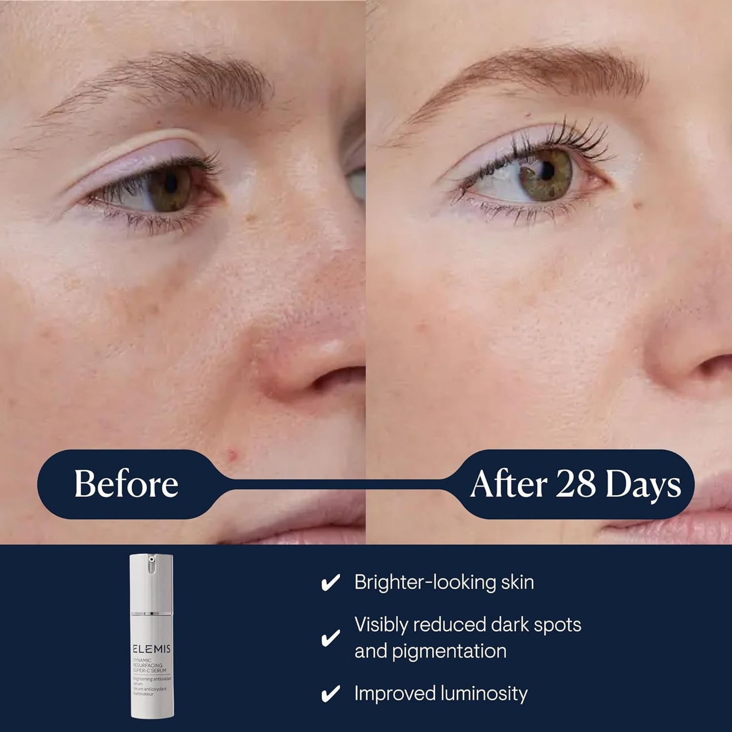 ELEMIS Dynamic Resurfacing Super-C Serum - Daily Anti-Aging Antioxidant for Bright, Refined Skin | 30 mL