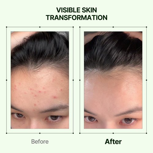 Orien Mugwort Zero Film Toner 5.41 fl.oz. 160ml ㅣpH5.5 Calming, Soothing, Hydrating Spray Toner