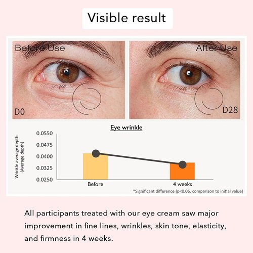 Revive Eye Serum - Dark Circle & Puffiness Eye Cream | Smooths Fine Lines, 30ml