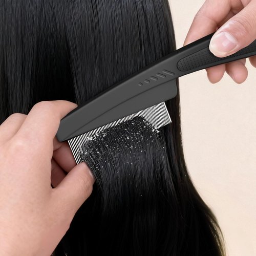 Dandruff Comb - Fine Tooth Scalp Detox Tool for Lice Removal | Stainless Steel Hair Brush (Black & Orange)