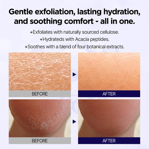 PONGDANG Deep Clean Soft Peeling Gel - Daily Exfoliator for Dead Skin & Blackhead Care | 4.23oz | Cruelty-Free Korean Skin Care