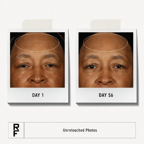 Rodan + Fields Redefine Triple Defense Cream - 2-in-1 Daily Moisturizer with SPF 30 | 1oz | Reduces Fine Lines, Wrinkles & Improves Firmness