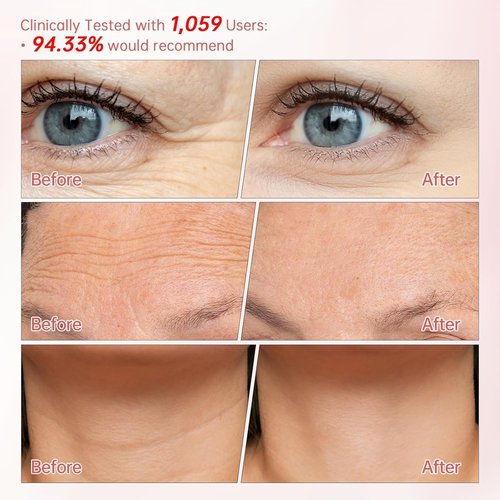 Peunitory Eye Balm Stick - Anti-Wrinkle Firming Treatment | Dark Circle Brightener | Hydrating 0.32oz