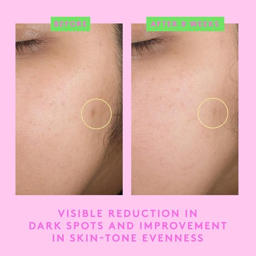 Drunk Elephant B-Goldi Bright Drops - 30 ml/1 fl oz - Illuminating Color Serum Drops - Clean Clinical Skincare - Cruelty-Free - Dermatologist-Tested - Free of Essential Oils, Silicones, and Fragrance
