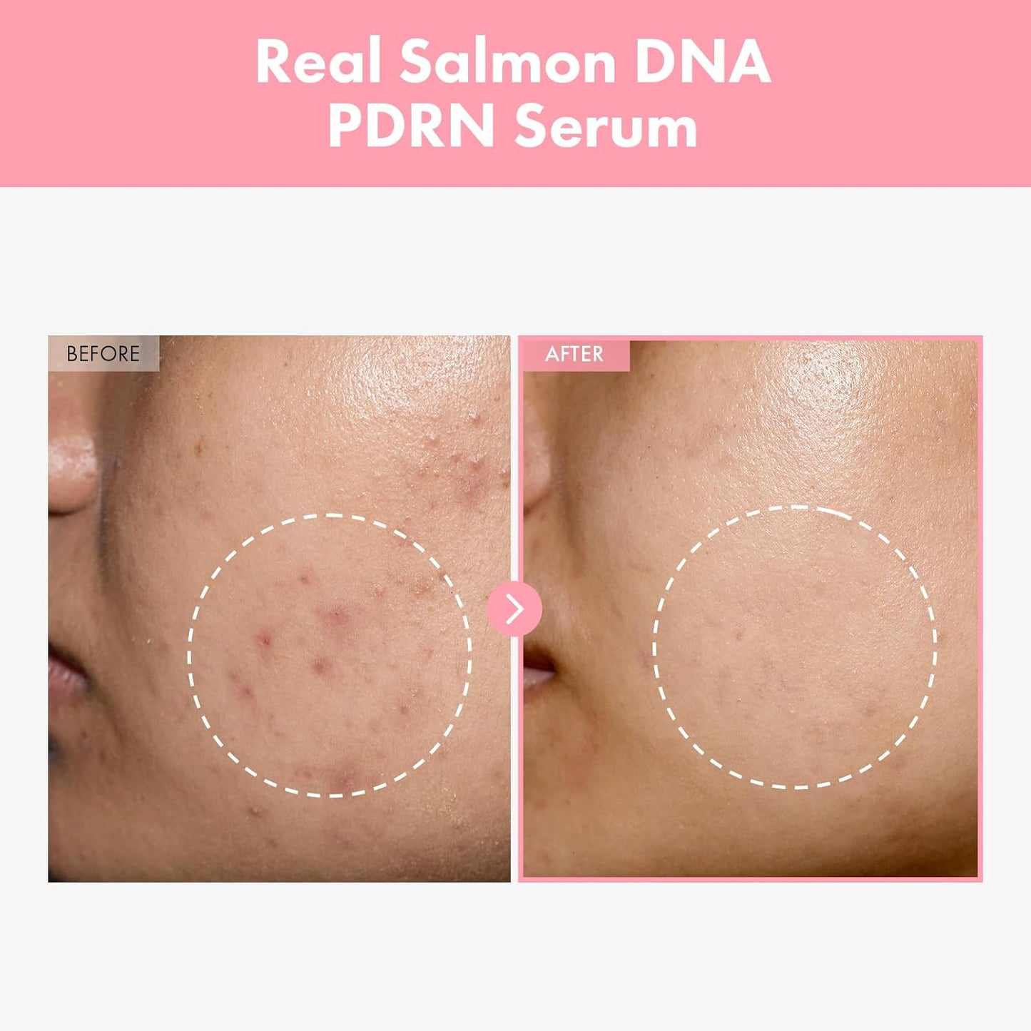 TOSOWOONG Pink Peptide 12 PDRN Serum - Hydrating & Firming with Salmon DNA & Niacinamide | 33ml