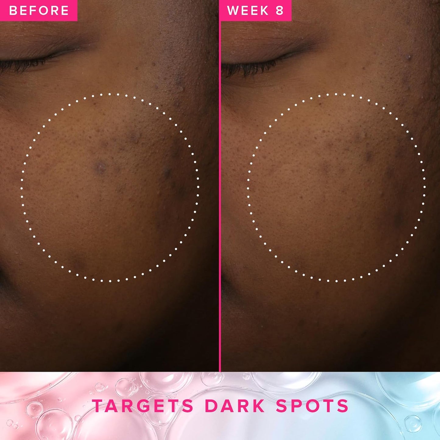 Farmacy 3% TXA Brightening Toner - Dark Spot Corrector with Azelaic Acid & Tranexamic Acid | 120ml