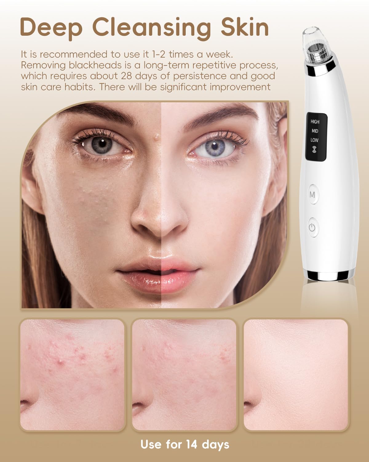 Facial Pore Blackhead Remover Vacuum - Face Cleaner and Blackhead Extractor with 3 Adjustable Suction Levels, 5 Probes, USB Charging Interface - Pore Vacuum Kit for Women&Men (White)