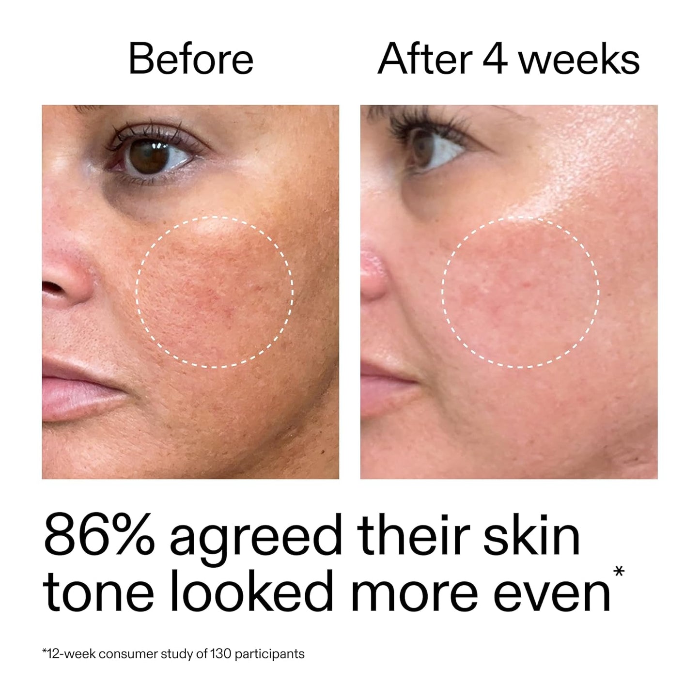 The INKEY List Dual Retinol Serum - Gentle Skin Renewal & Hydration | 1 Fl Oz, 0.5% Amisol Trio
