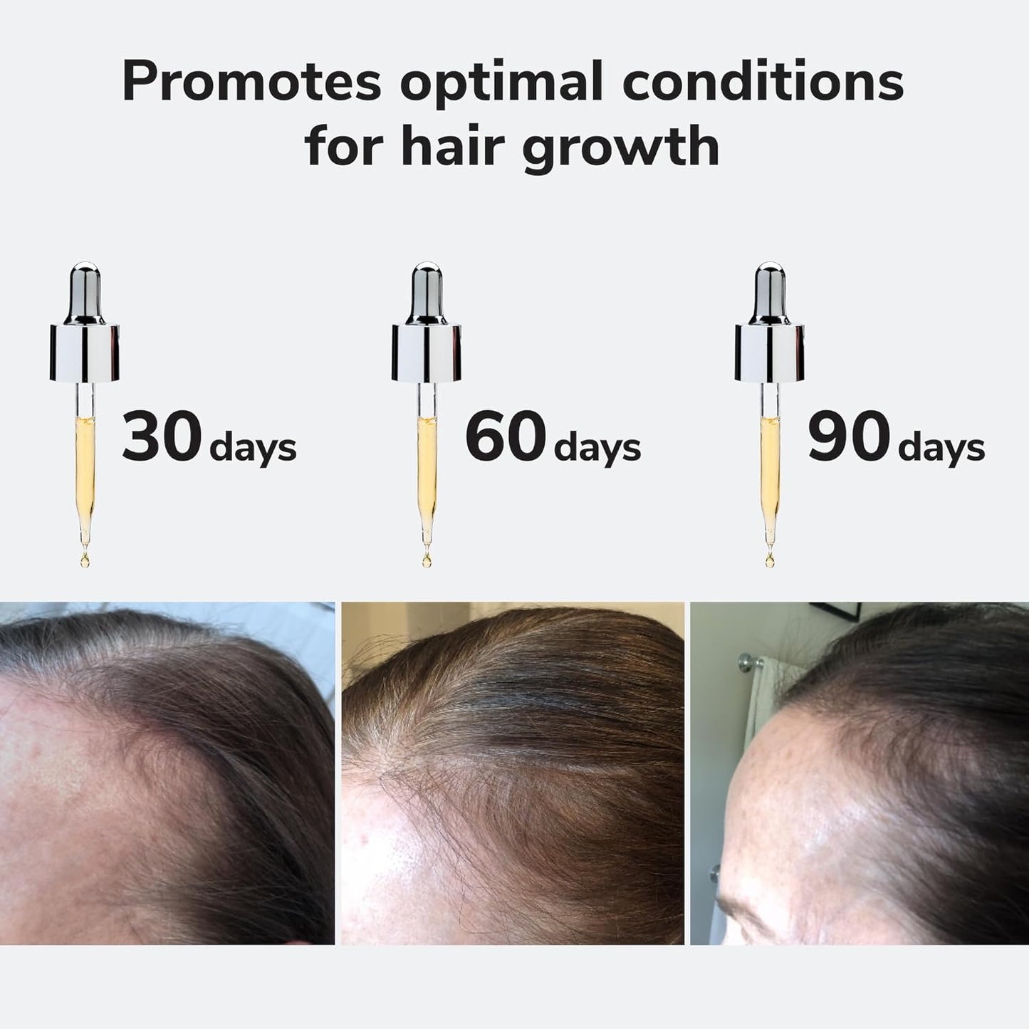 Color Wow Youth Juice Collagen Scalp Treatment - Boosts Scalp Collagen for Stronger, Thicker Hair | Optimal Growth Conditions
