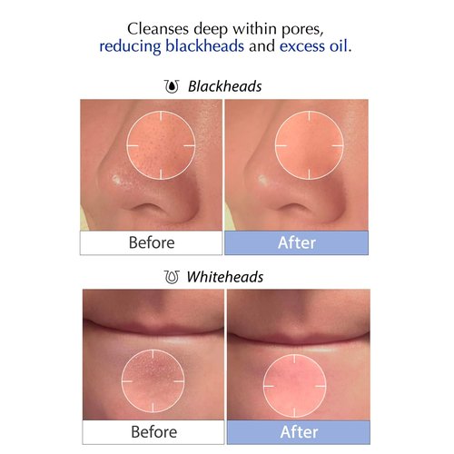 MSM Sulfur Deep Pore Cleanser - Gentle Low pH Face Wash for Sensitive Skin, Pore Reset Formula