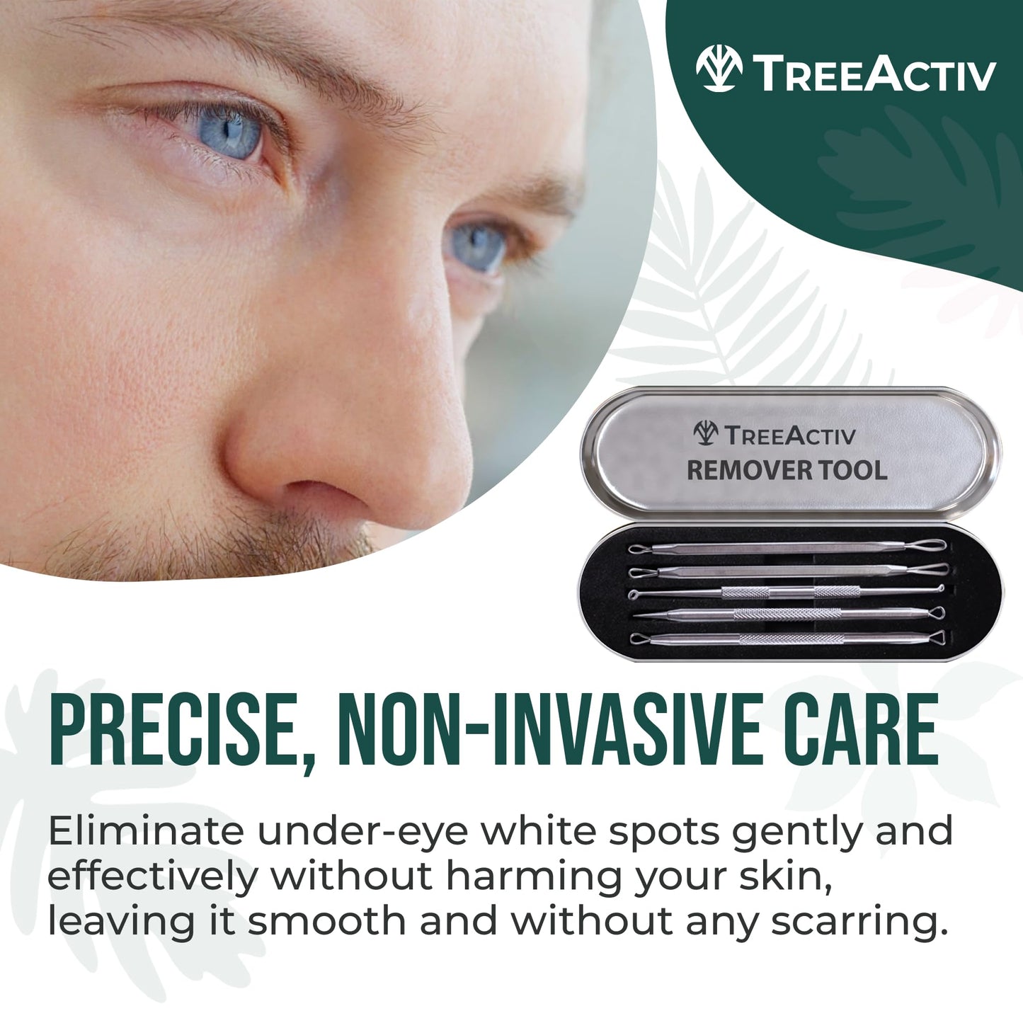 TreeActiv Spot Treatment 0.5oz + Remover Kit Bundle, Includes Spot Treatment and Remover Tool, Bentonite Clay, Tea Tree Oil, Aloe Vera, Clearer Skin in 2 Weeks