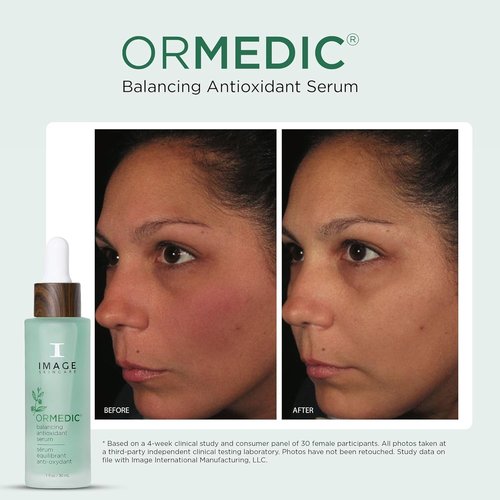 IMAGE Skincare ORMEDIC Balancing Antioxidant Serum - Hydrates & Soothes with Aloe Vera & Vitamin C, 1 fl oz
