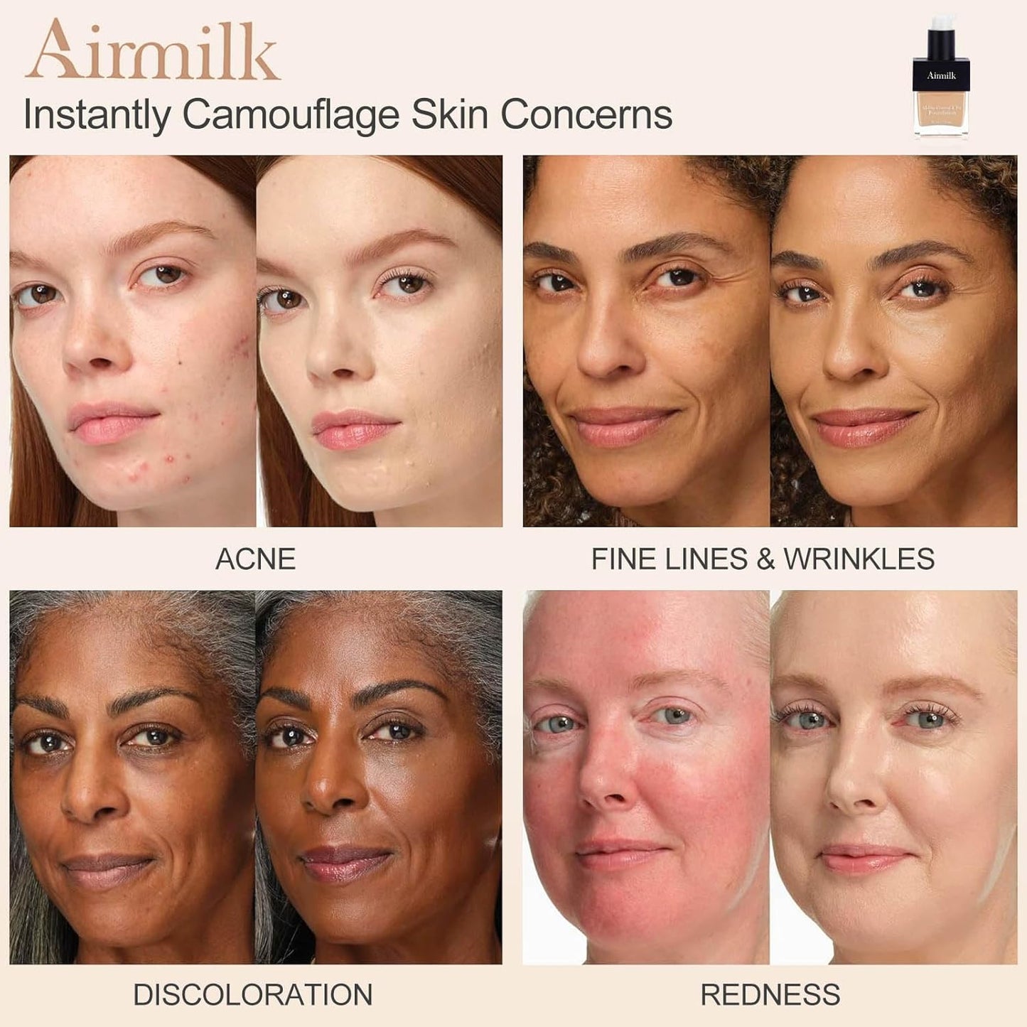 Skiennix Foundation for Acne-Prone Skin - Skincare Makeup with Salicylic Acid | 30ml Light Neutral