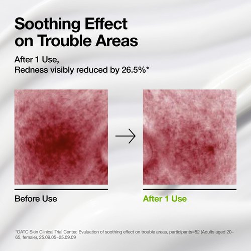 ANUA Azelaic Acid CICA Skin Soothing Moisturizer, Lightweight & Redness Relief, For Acne Prone Skin, Fragrance Free, Korean Skincare, 3.38 fl oz