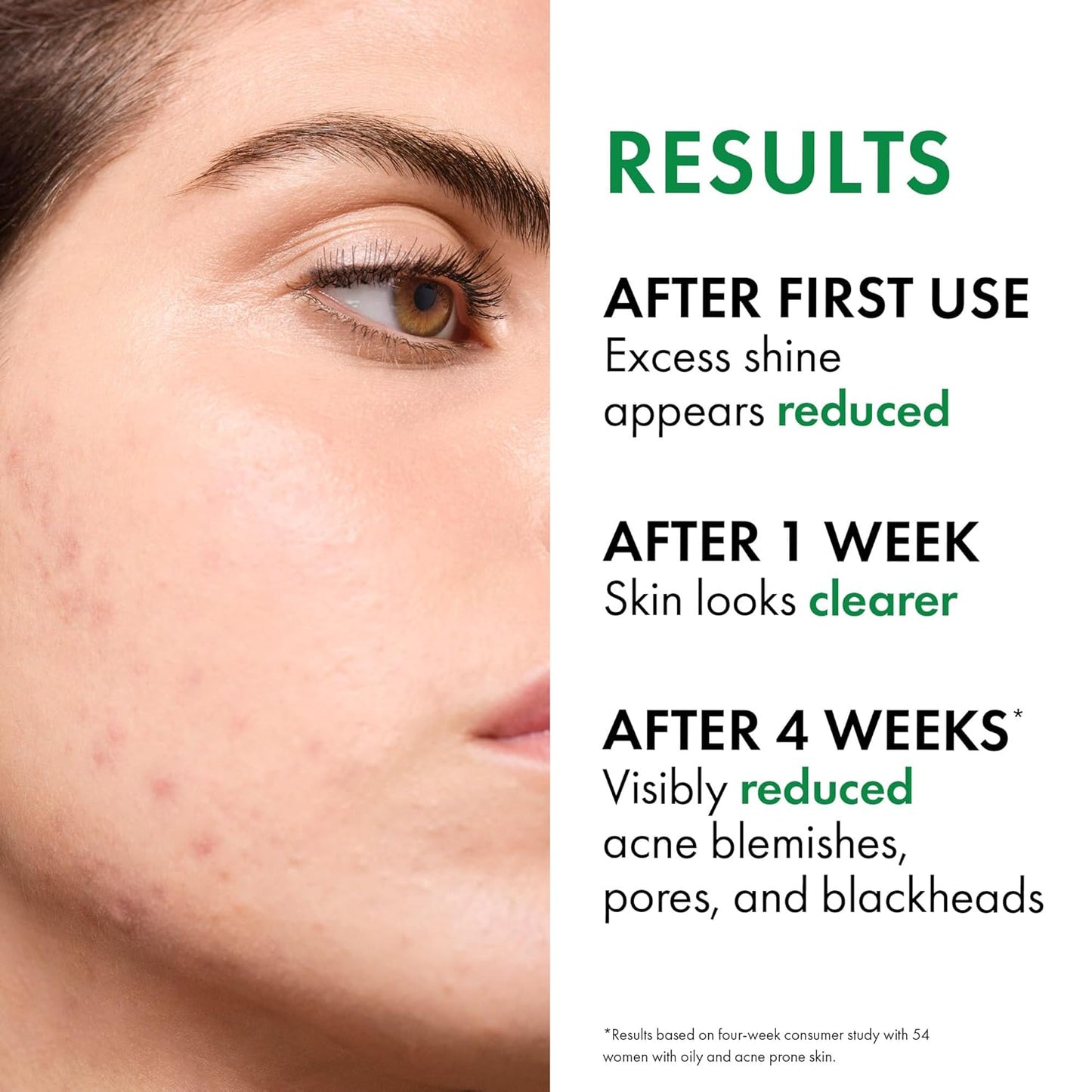 VICHY Normaderm Daily Acne Face Wash - Salicylic Acid Cleanser for Oily Skin | Clears Clogged Pores