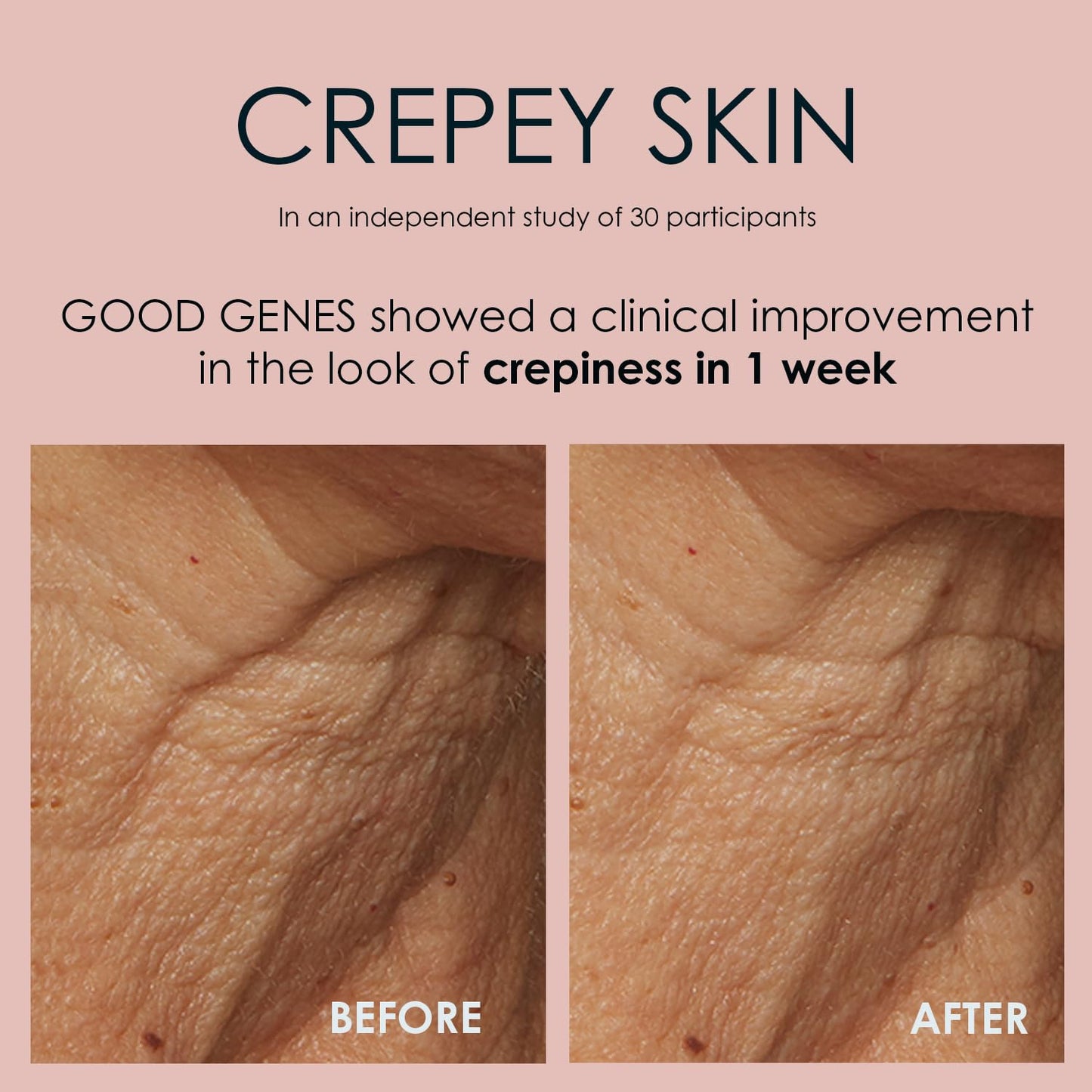 Sunday Riley Good Genes Lactic Acid Treatment - All-in-One Face Serum for Radiant Skin