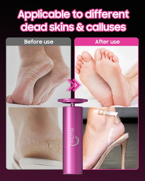 HayZBao FSA&HSA Electric Foot Callus Remover - Callus Remover for Feet,Professional Pedicure Tool for Dead Skin,Electric Foot File with 60 Pcs Sandpaper Discs - Pink