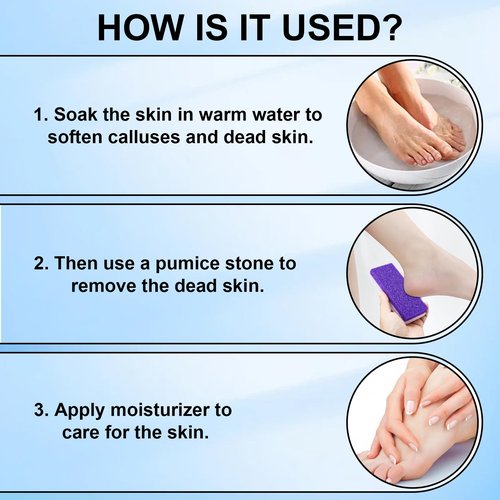 Foot Pumice Stone 4 Pack Pedicure Stone for Feet Pumice Sponge for Feet Callus Remover and Scrubber Double Sided Pedicure Foot Pumice Stone for Feet and Heels Callus and Dead Skins (Purple)