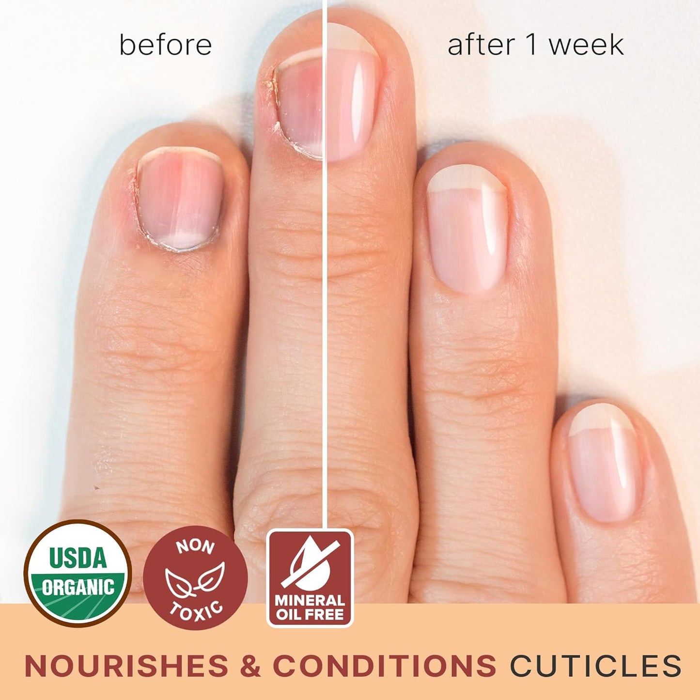 Skiennix Organic Nail & Cuticle Oil - Strengthens & Repairs Damaged Nails | Jojoba & Vitamin E, USA Made