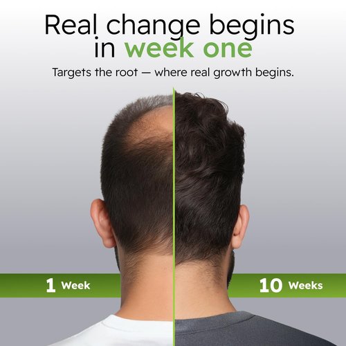 Scalp Nourishing Serum for Men by [Brand Name] - Ginseng & Eclipta Blend for Thicker Hair - 60ml