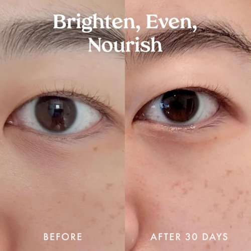 Kopari Ceramide & Retinol Eye Balm - Hydrating Anti-Aging Treatment for Fine Lines & Puffiness